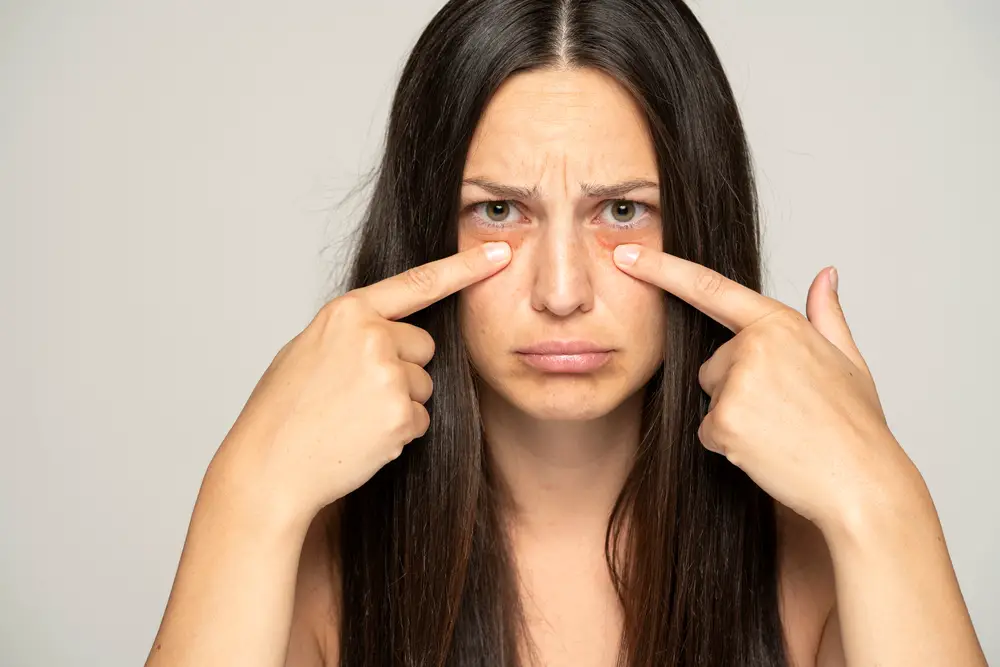 Causes des cernes