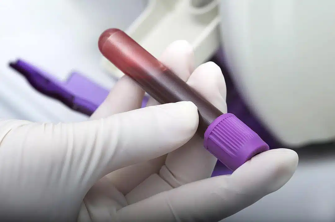 Test sanguin en laboratoire