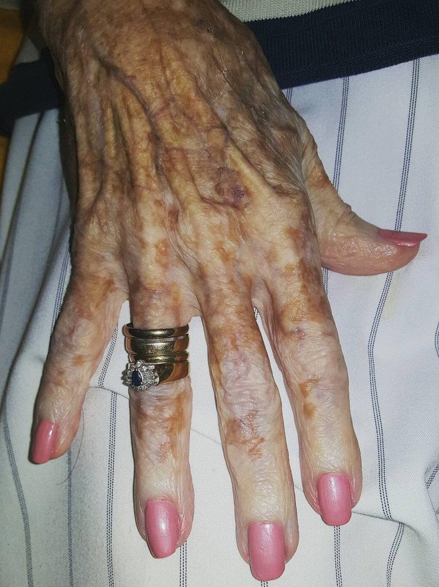 Main d'une personne &acirc;g&eacute;e recevant une manucure attentionn&eacute;e