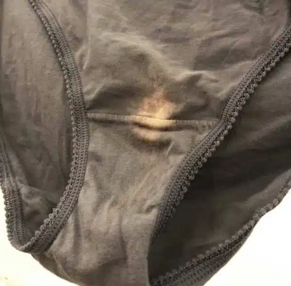 Exemple de taches sur sous-vêtements