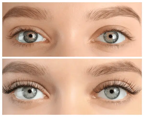 Transformation des cils avant/après traitement
